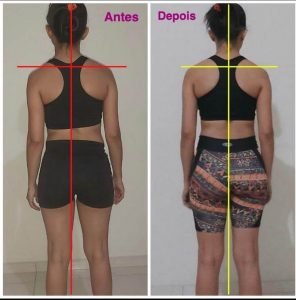 Coluna alinhada e reduzão de gordura corporal.